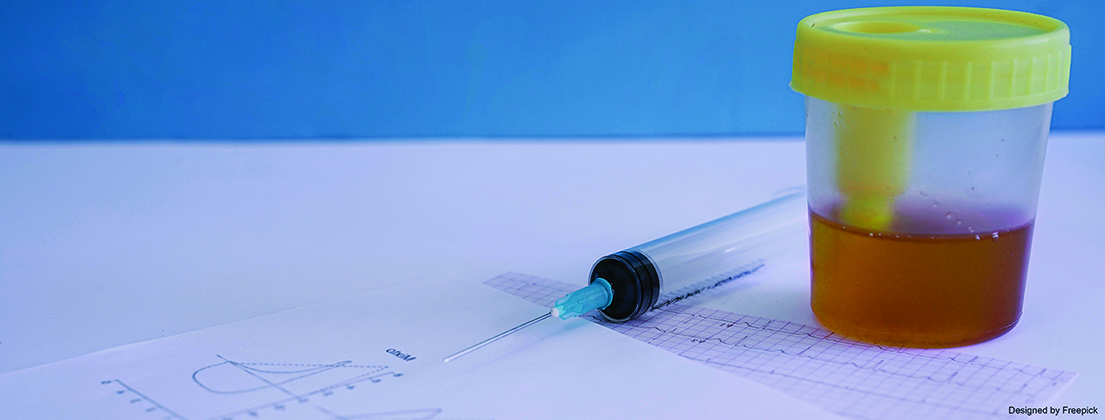 PSA purification and concentration from urine samples for non-invasive ...
